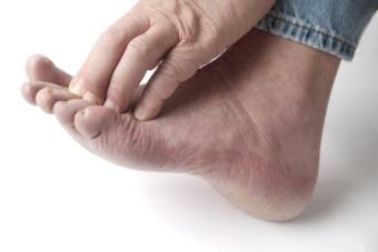 Diabetic Peripheral Neuropathy and Foot Ulcers