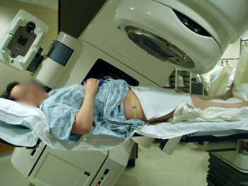 Radiation Therapy Patient - from Wikipedia